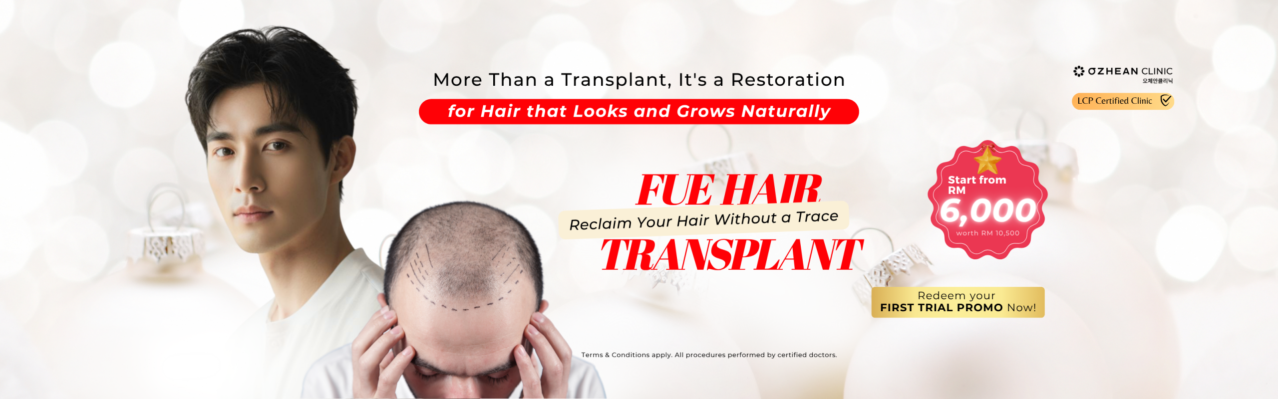 hair transplant FUE