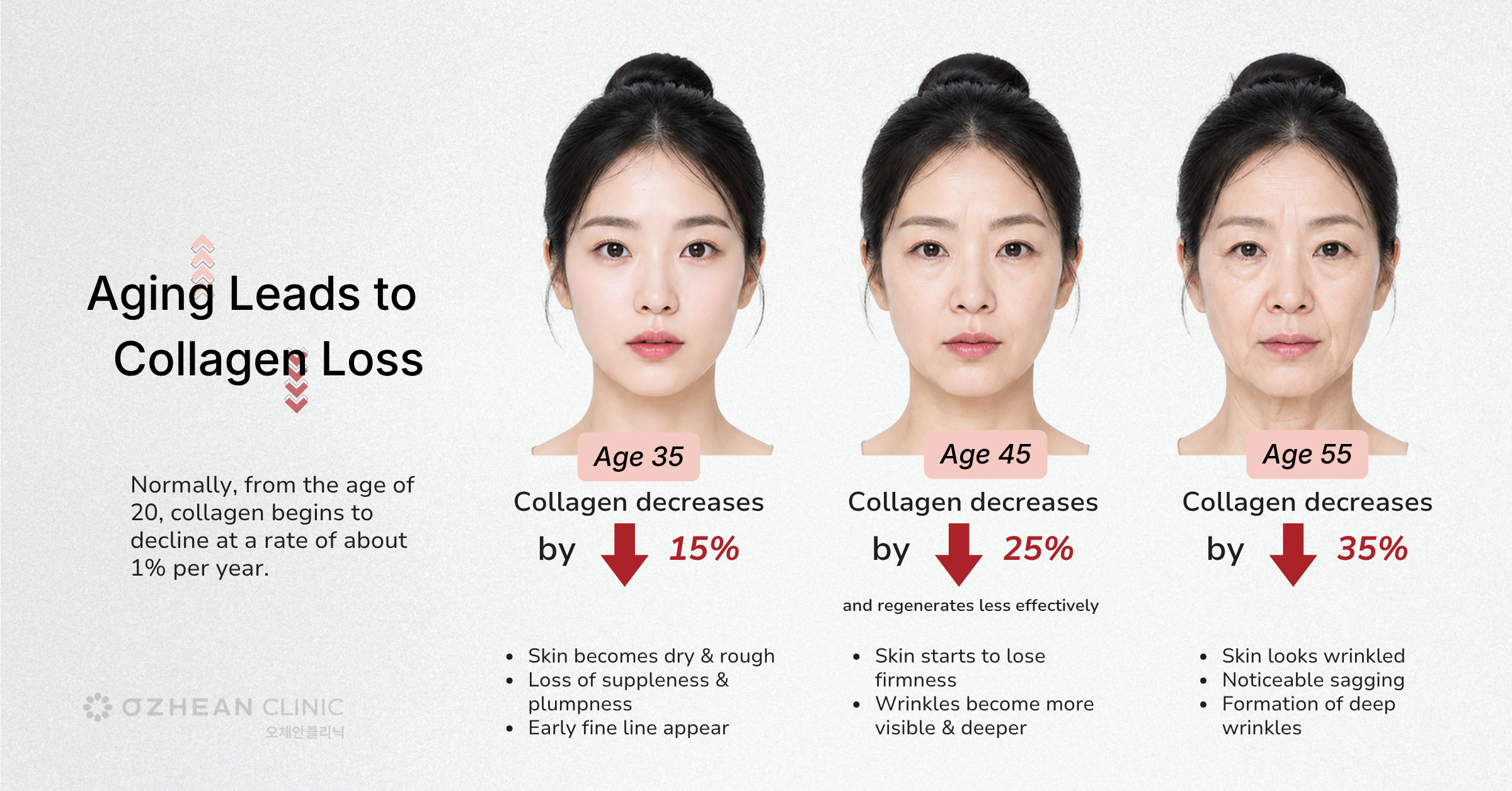 aging-leads-to-collagen-loss-ozhean-clinic