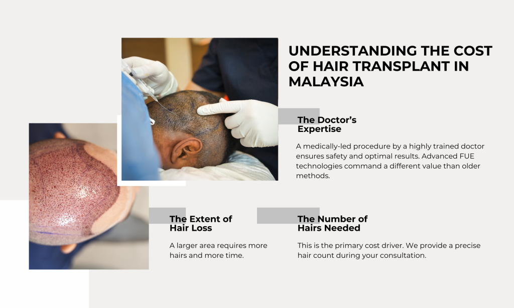 hair-transplant-ozhean-clinic-3