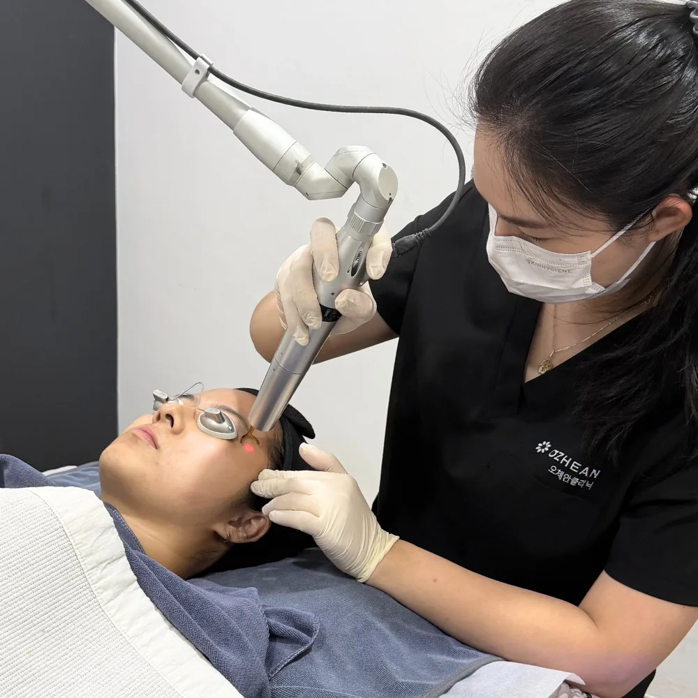 Laser vs Chemical Peel for Pigmentation in Malaysia: Which One Suits You?