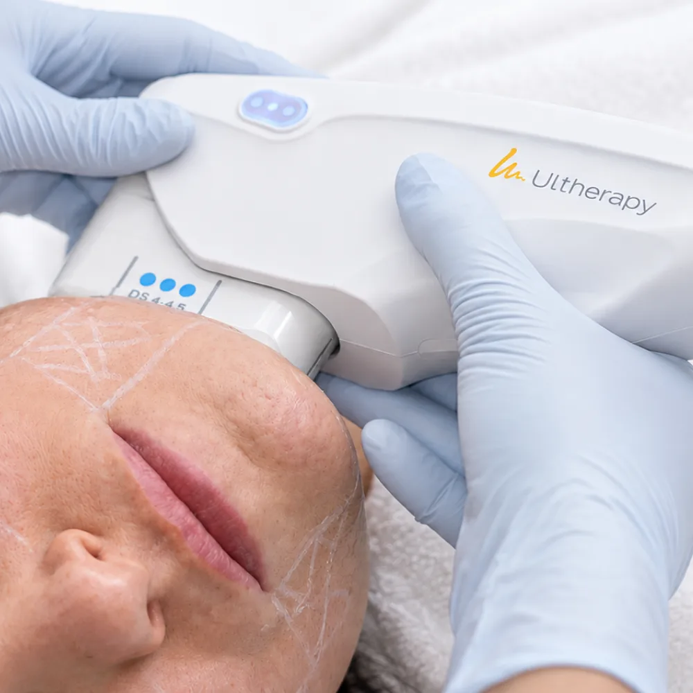 What to Expect From Ultherapy Prime Neck in Malaysia: Time, Comfort and Results