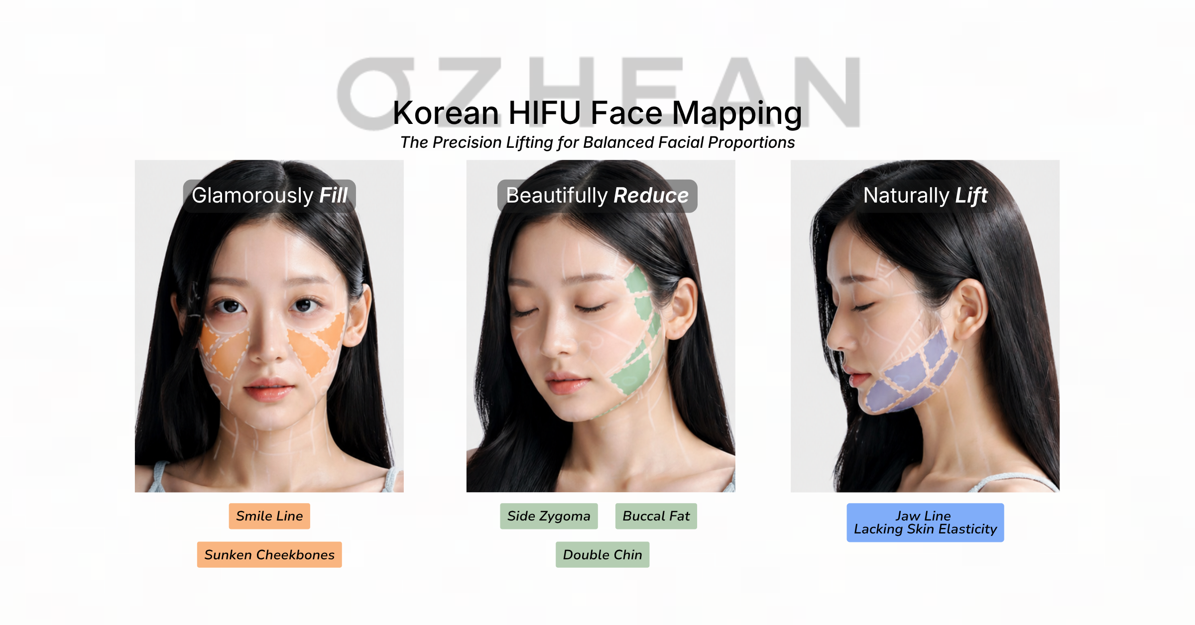 korean-hifu-face-mapping-ozhean-clinic