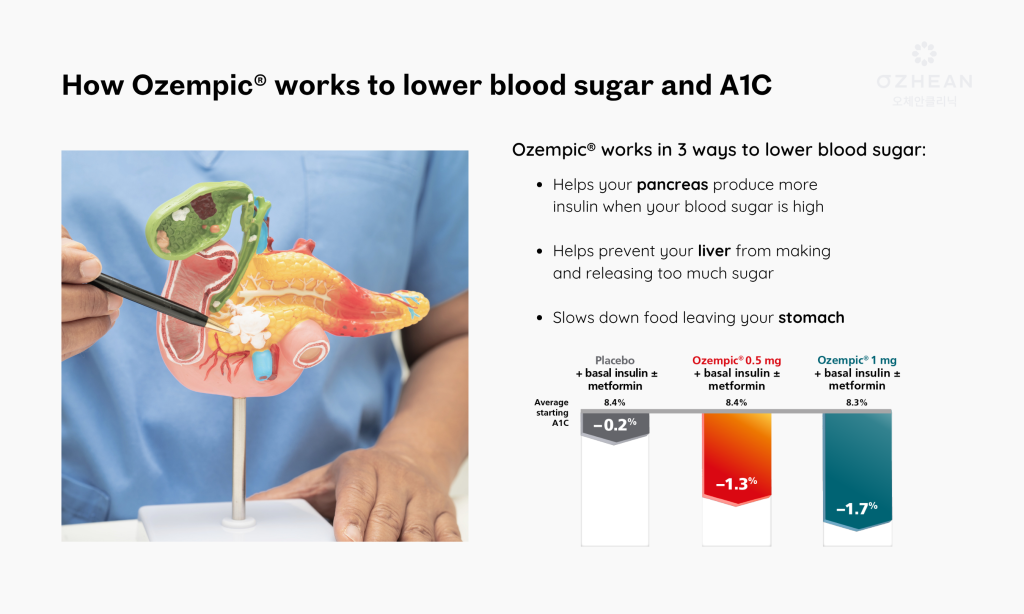 medical-weight-loss-solutions-malaysia-ozhean-clinic-5