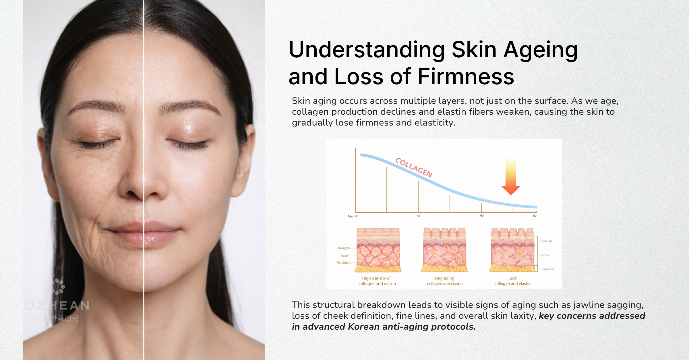 skin-aging-firmness-ozhean-clinic